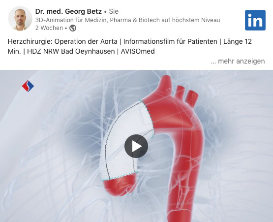 Operation of the main artery, aorta