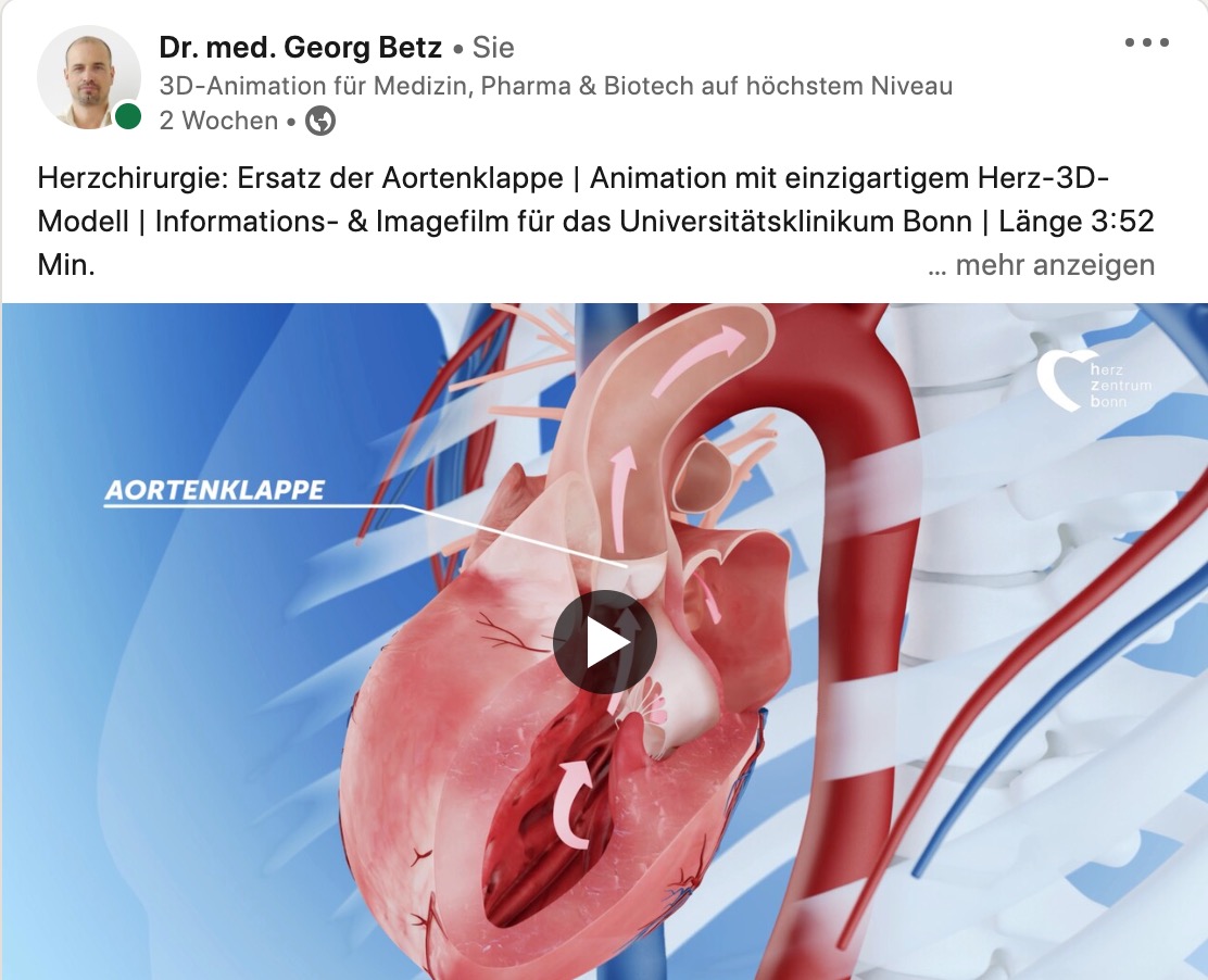 Informationsfilm Operation der Hauptschlagader