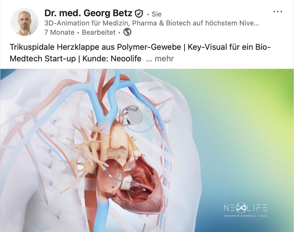 Key Visual: Trikuspidale Herzklappe aus Polymer-Gewebe