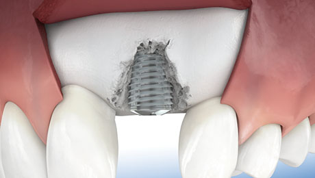 Dental illustrations