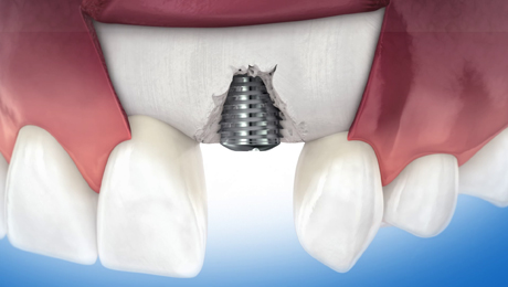 Dentalfilmreihe