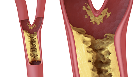 Angiologie