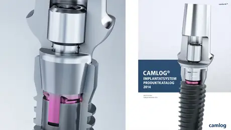 Dental implant Dental implant