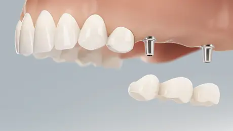 Dental illustrations Dental illustrations
