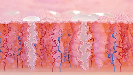 Heavy Menstrual Bleeding