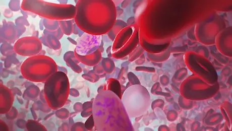 Iron Deficiency Anaemia Iron Deficiency Anaemia